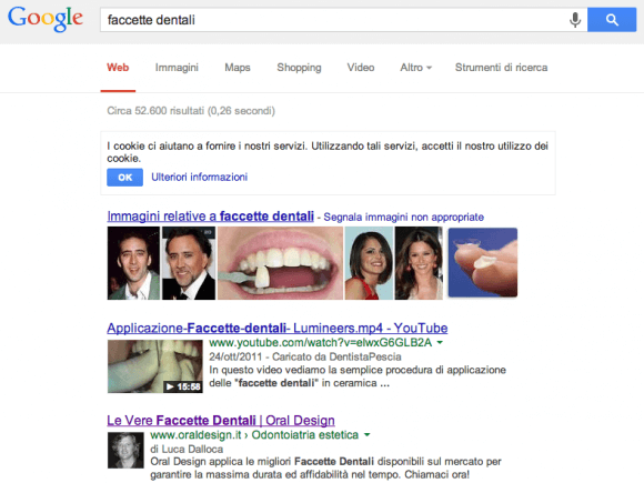 Oral Design Faccette Dentali